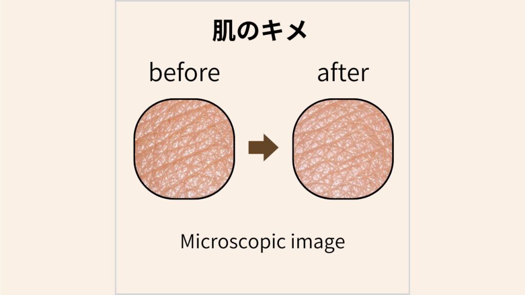 マイクロスコープで撮影した肌のキメのBefore/After画像