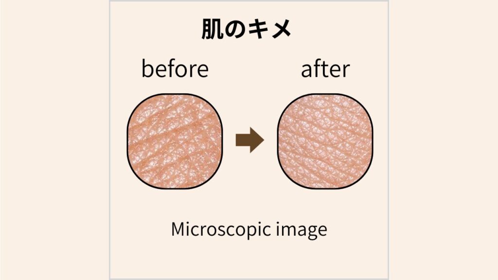 マイクロスコープで撮影した肌のキメのBefore/After画像