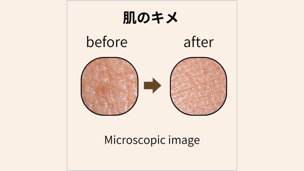 マイクロスコープで撮影した肌のキメのBefore/After画像