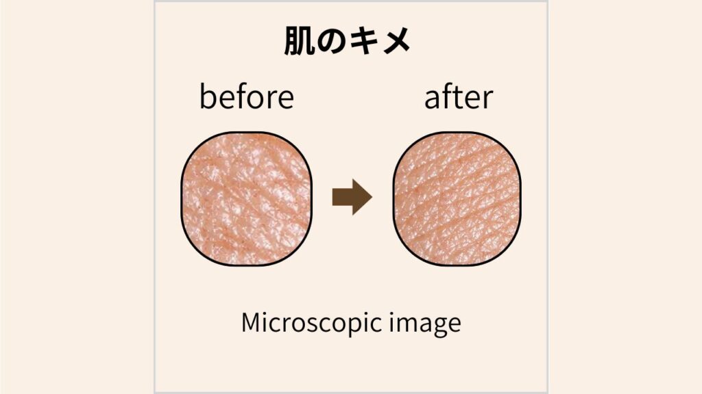 マイクロスコープで撮影した肌のキメのBefore/After画像