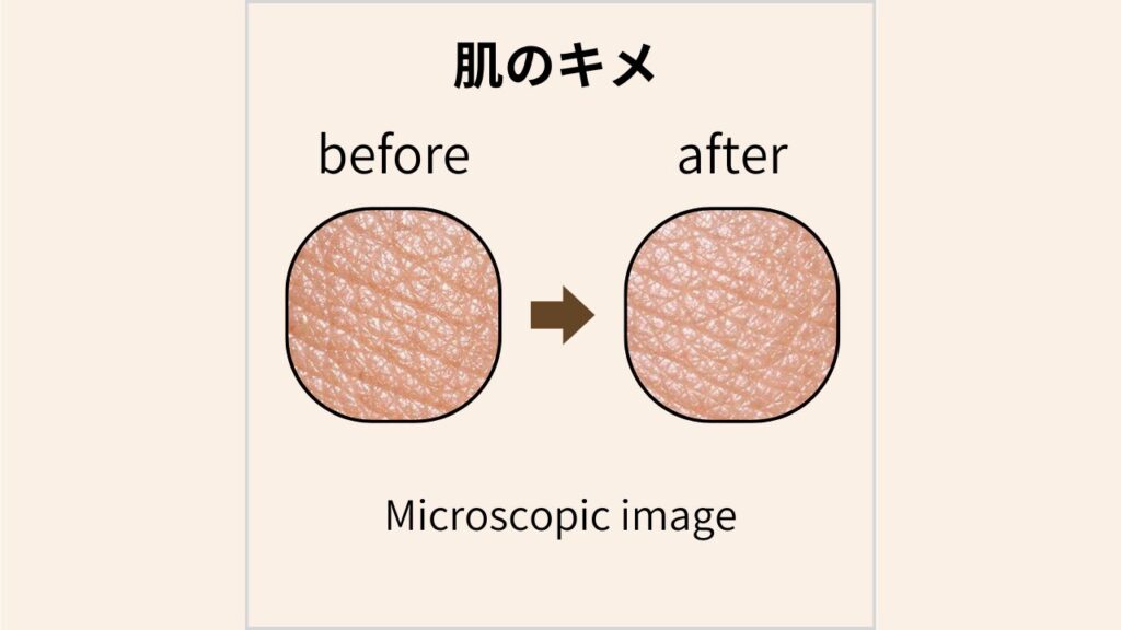 マイクロスコープで撮影した肌のキメのBefore/After画像