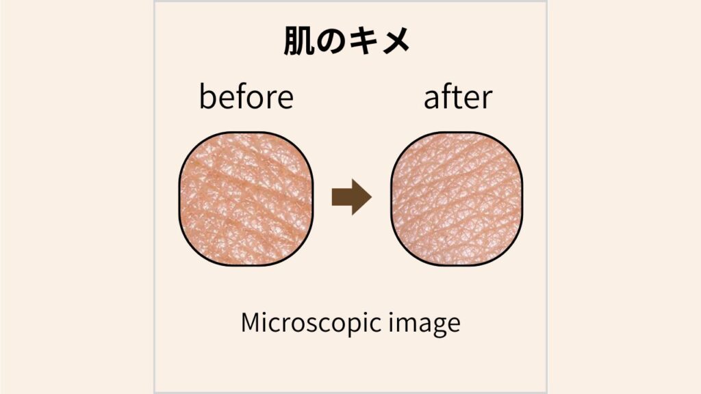 マイクロスコープで撮影した肌のキメのBefore/After画像