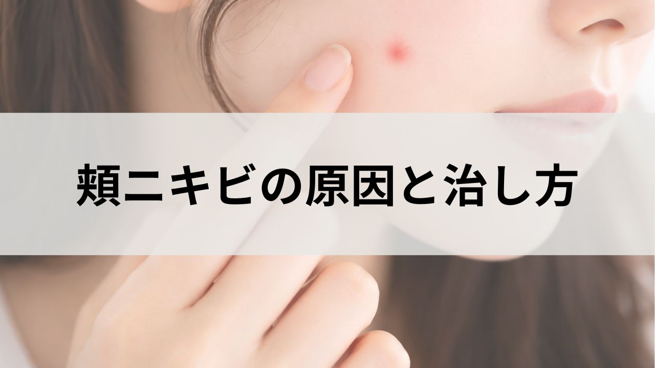 頬ニキビの原因と治し方｜大人ニキビができやすい理由を解説