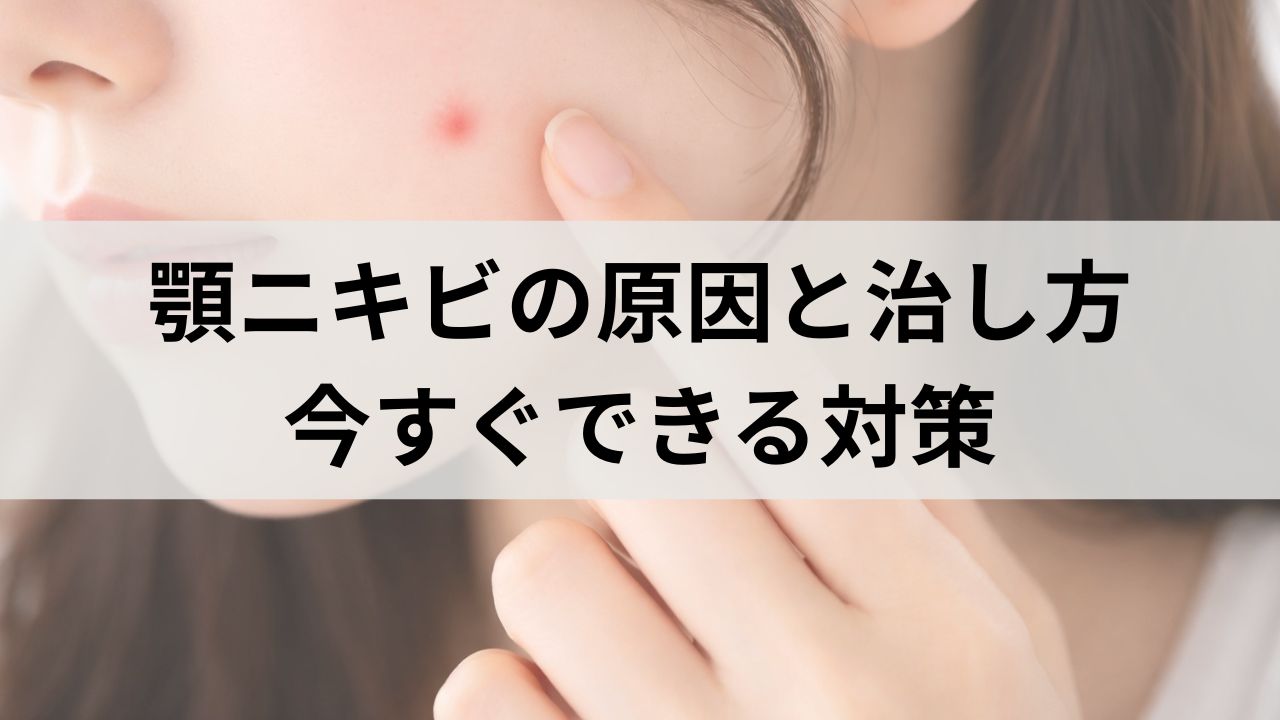 顎ニキビの原因と治し方｜繰り返す理由と今すぐできる対策