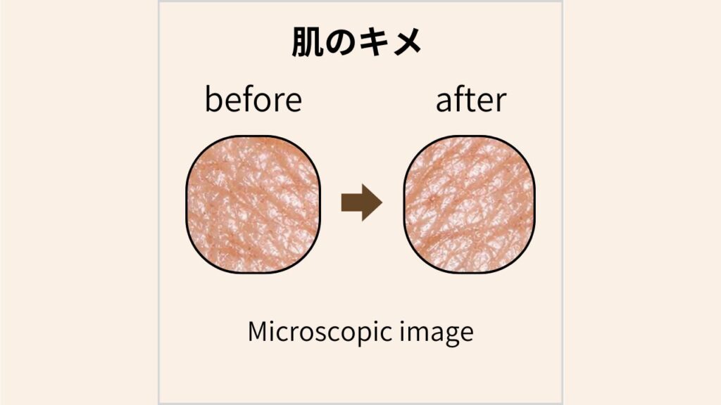 マイクロスコープで撮影した肌のキメのBefore/After画像
