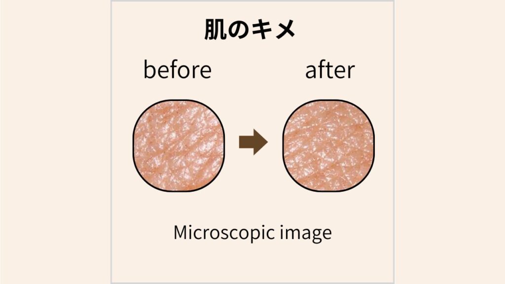 マイクロスコープで撮影した肌のキメのBefore/After画像