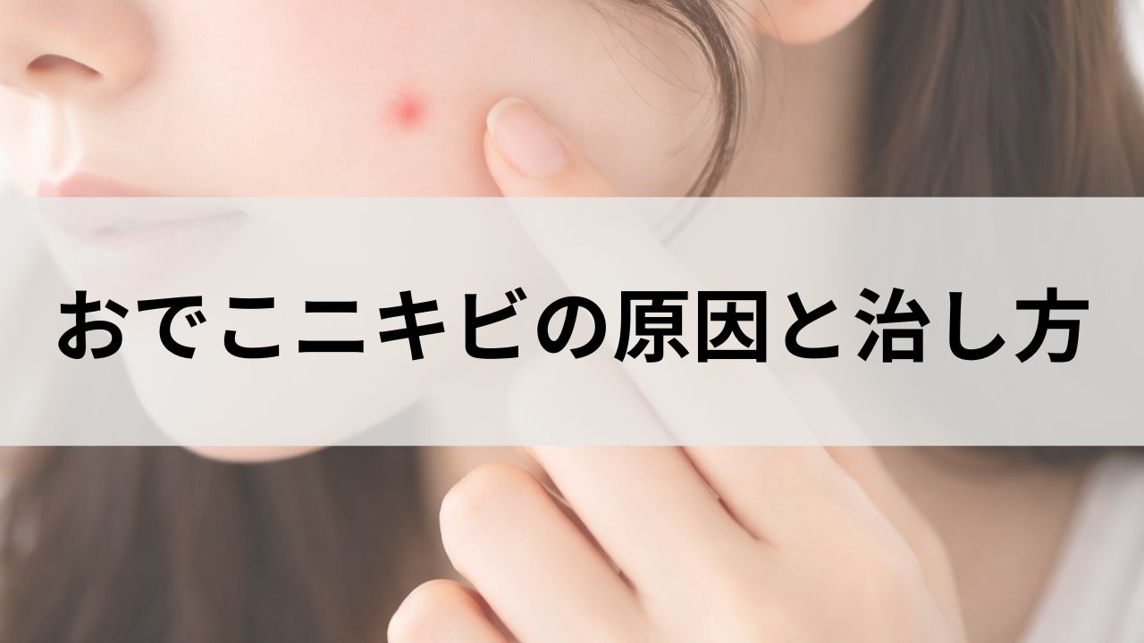 おでこニキビの原因と治し方｜思春期ニキビができやすい理由