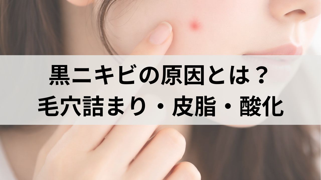 黒ニキビの原因とは？毛穴詰まり・皮脂・酸化の仕組みを解説
