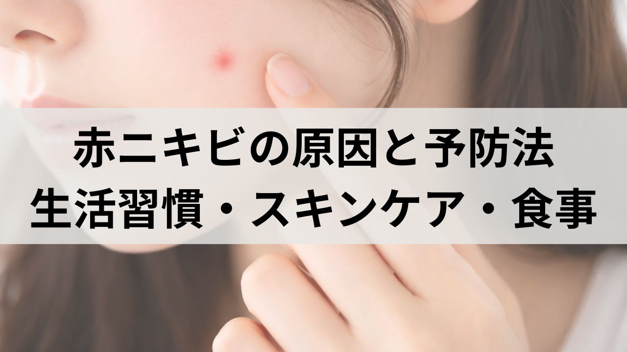 赤ニキビの原因と予防法｜生活習慣・スキンケア・食事でできる対策