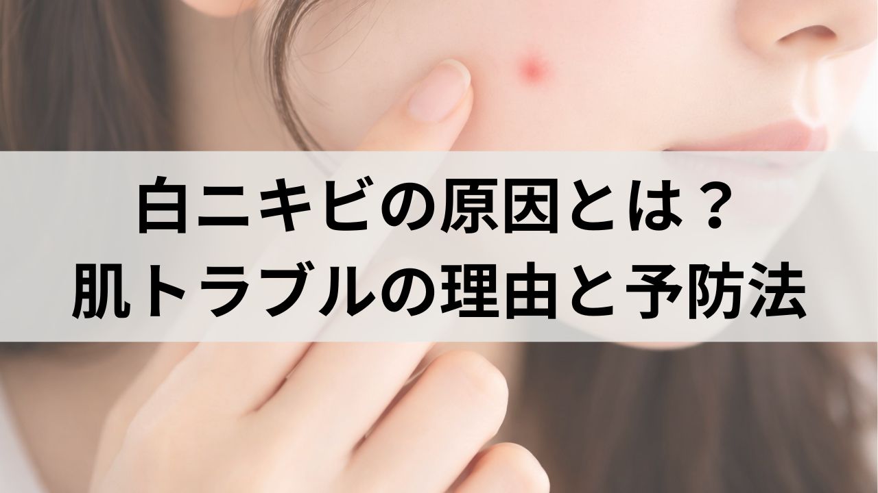 白ニキビの原因とは？知っておきたい肌トラブルの根本理由と予防法