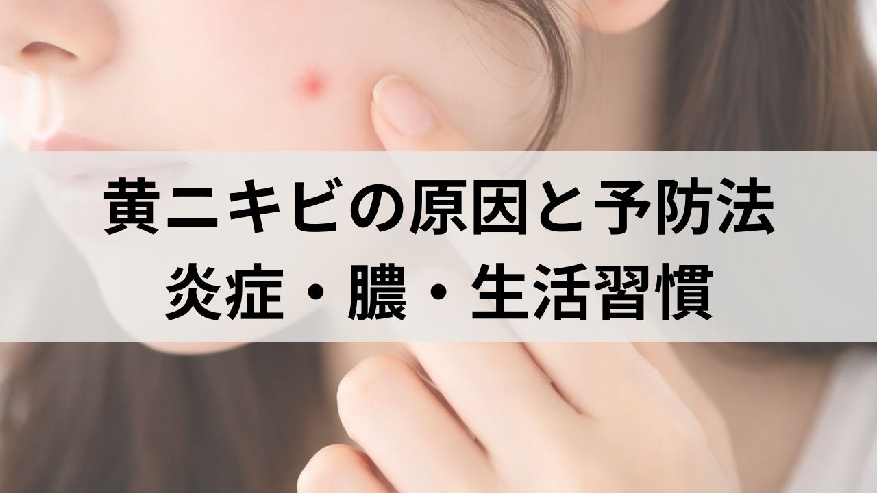 黄ニキビの原因と予防法｜炎症・膿・生活習慣・スキンケア対策